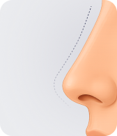 جراحی بینی ترمیمی